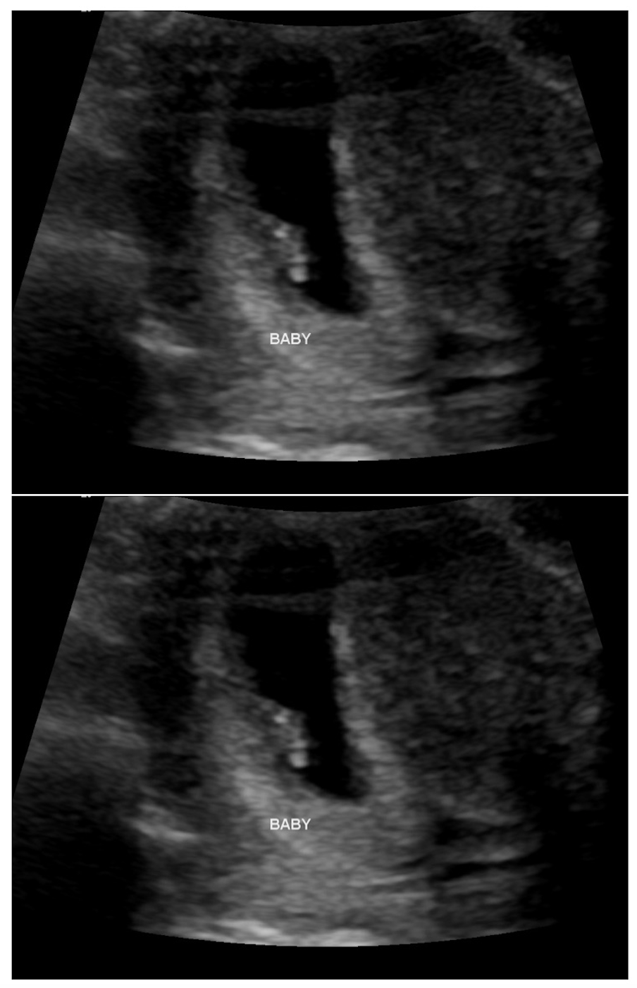 Ultrasound photos